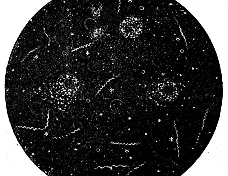 <p>Which contrast method is this? What external components does it require?</p>