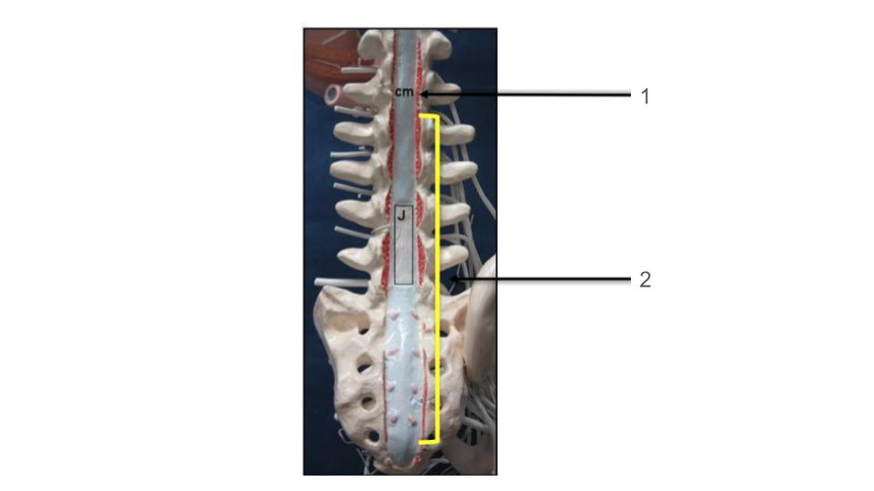 <p>2, region</p>