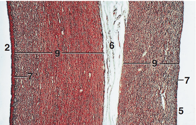 <p>Part and stain?</p>