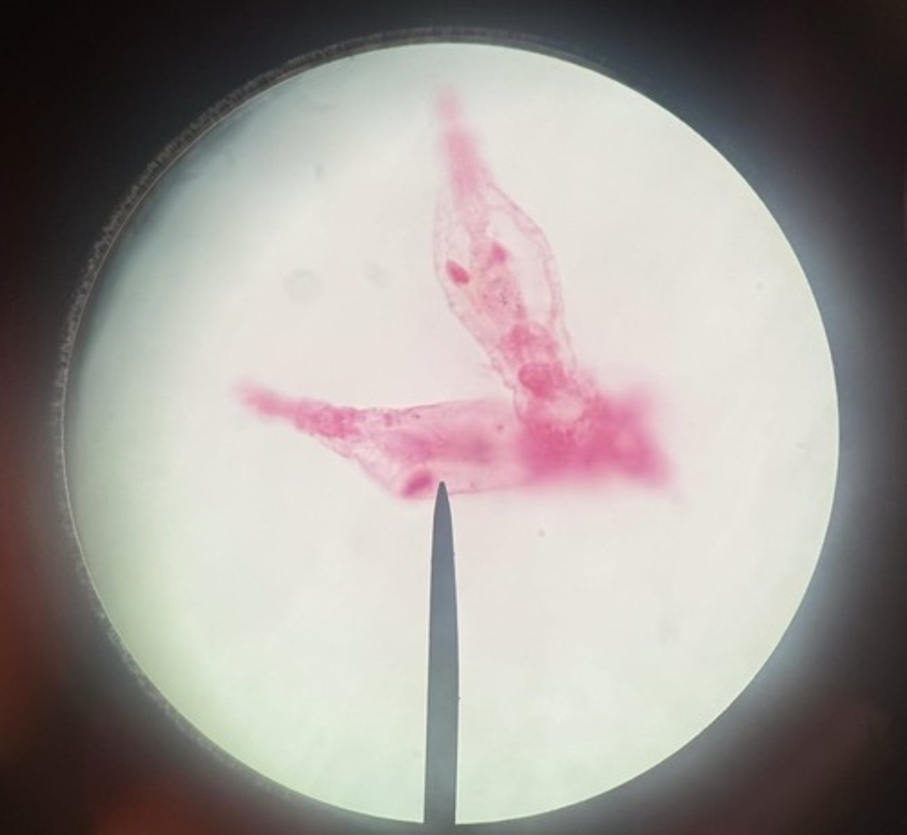 <p>subkingdom eumetaoza</p><p>phylum rotifera</p><p>mastax, corona, spur</p>