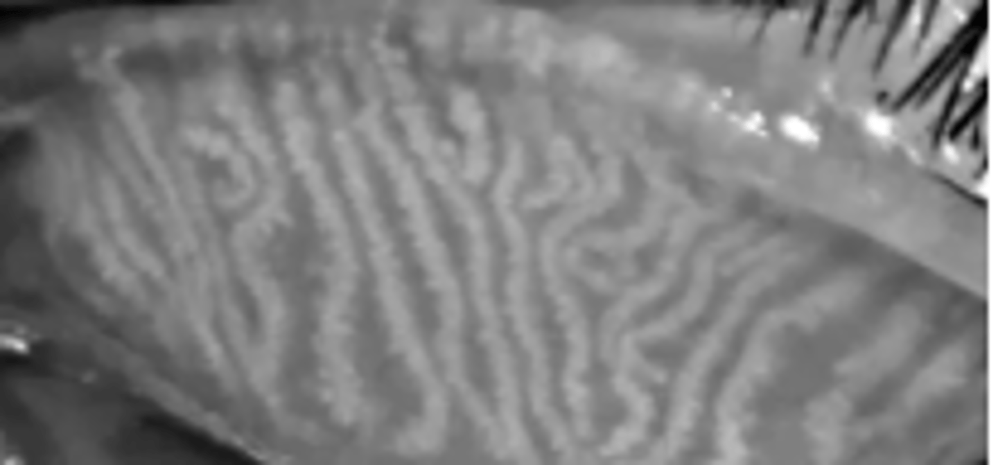 <p>Allergic conjunctivitis can result in ____ of ____ meibomian glands</p>