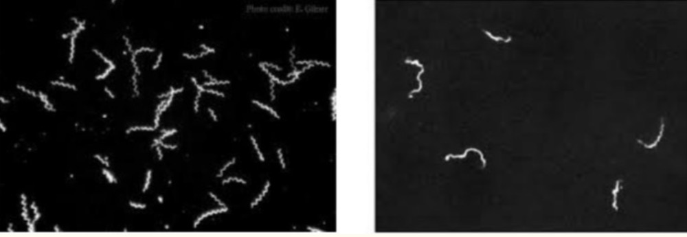 <p><strong>Identify</strong> :</p><p><strong>Comment</strong>:</p><p><strong>Can give false negative results in</strong> :</p>