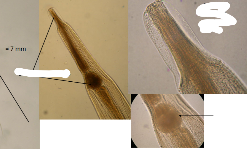 <p>What is this parasite and what are the structures</p>