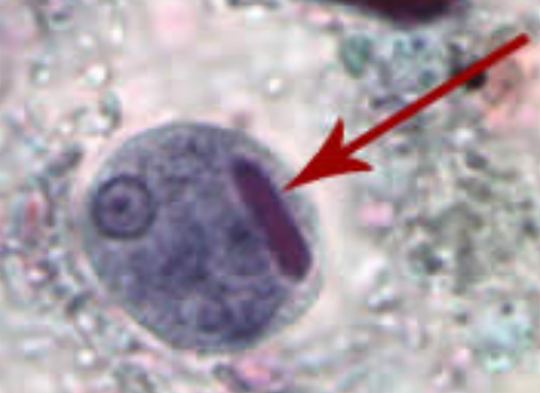 <p>Species Name:<br>Pointed in Arrow: <br>Stage:<br>Infective and Invasive stage:<br>Primary Host and Reservoir:</p>