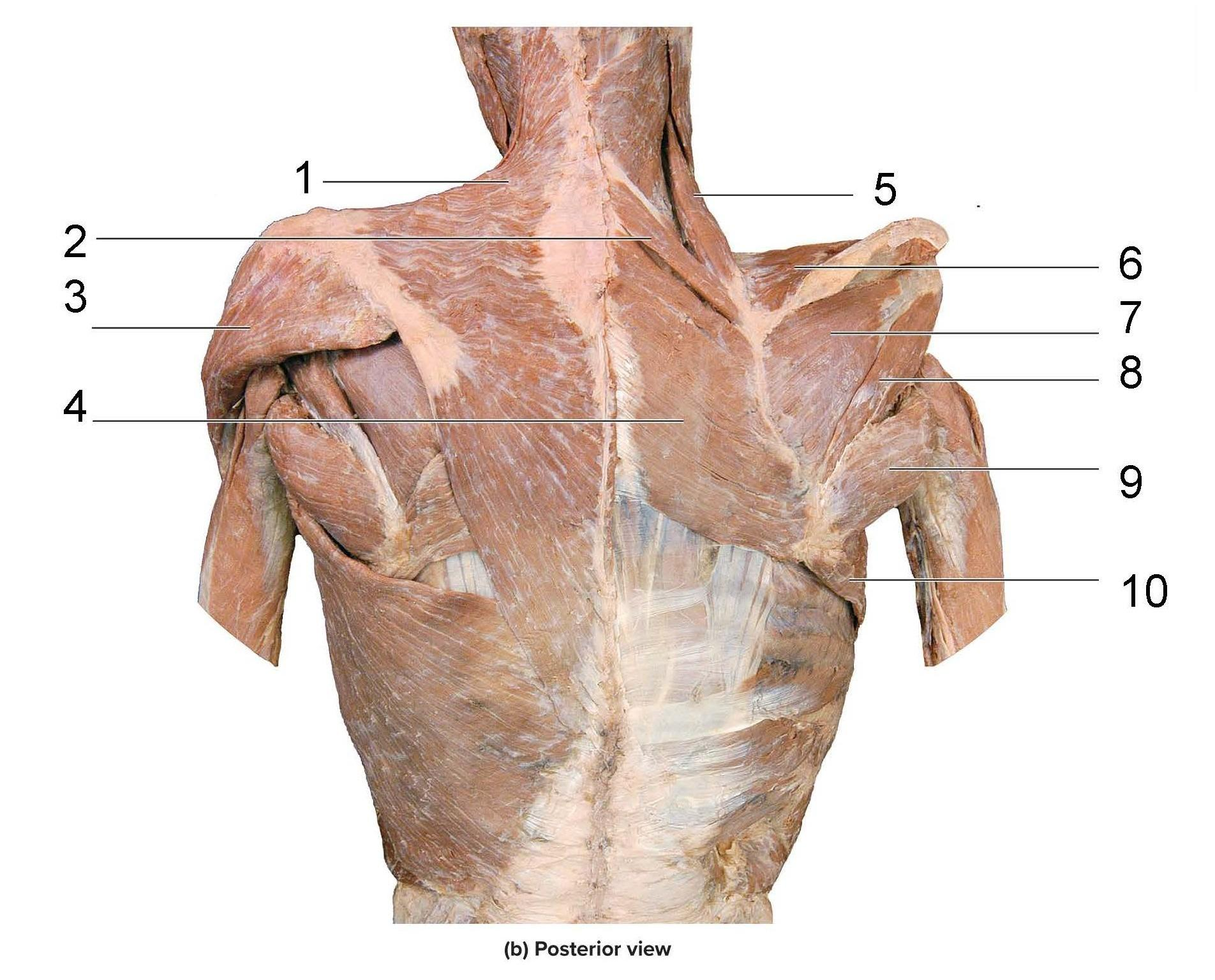 <p>What is identified in the photo 1-10</p>