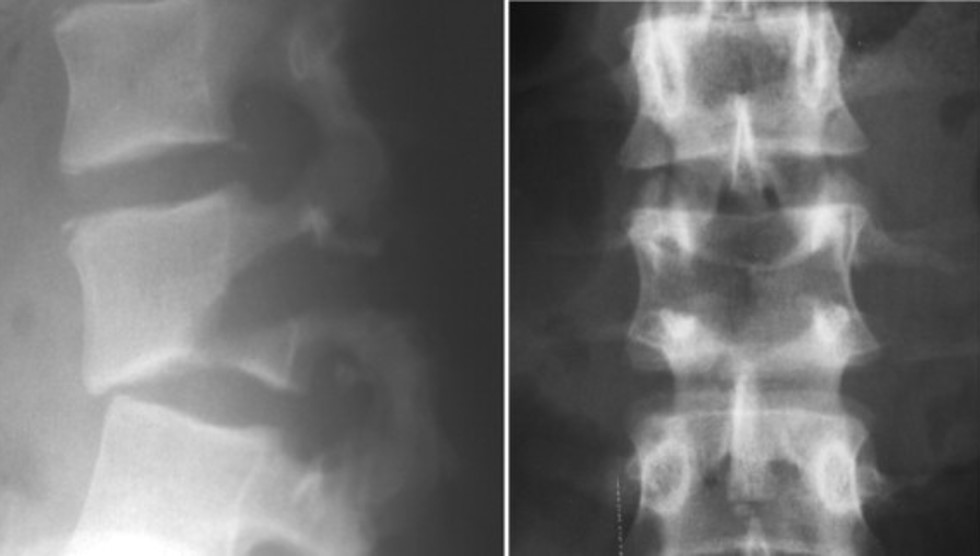 <p>What is the diagnosis?</p>