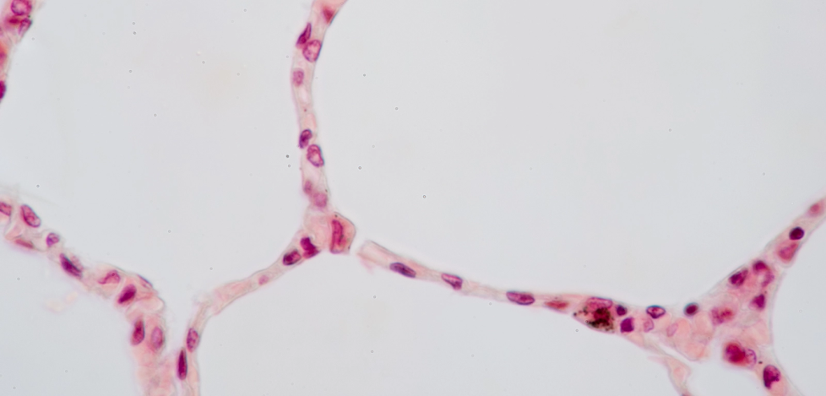 <p>alveoli</p>