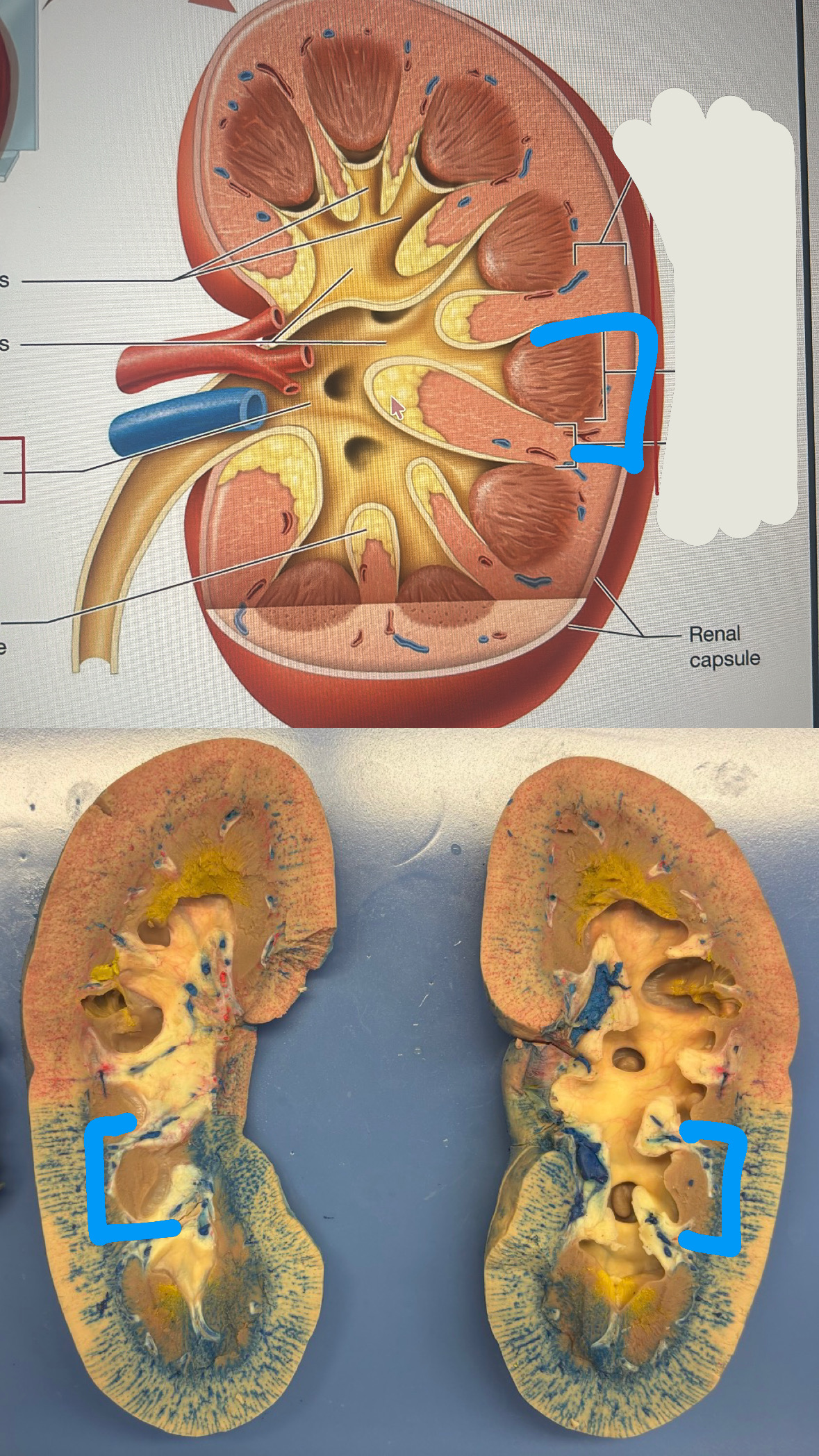 <p>renal medulla</p>