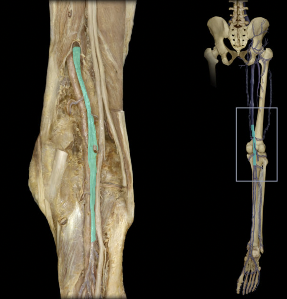 <p>Identify the blood vessel of the lower extremity</p>