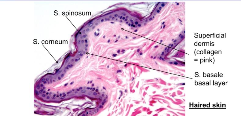<p>Left: s. spinosum too, s. corneum lower</p><p>right: Superficial dermis = pink, lower = s.basale layer</p>