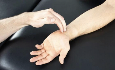 <p>A tingling or prickling sensation felt when lightly tapping over the nerve distal to the site of injury.</p>