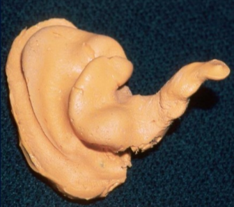 <p>sinuous S-shaped canal ensures that the velocity of the air slows so bacteria/dust etc doesn’t travel further into the ear to the tympanic membrane </p>