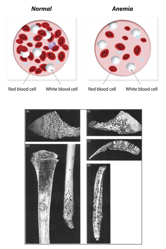 <p>Vascular Disease</p>