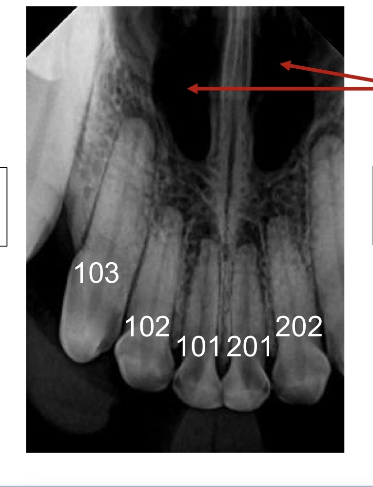 <p>what are the arrows pointing to?</p>