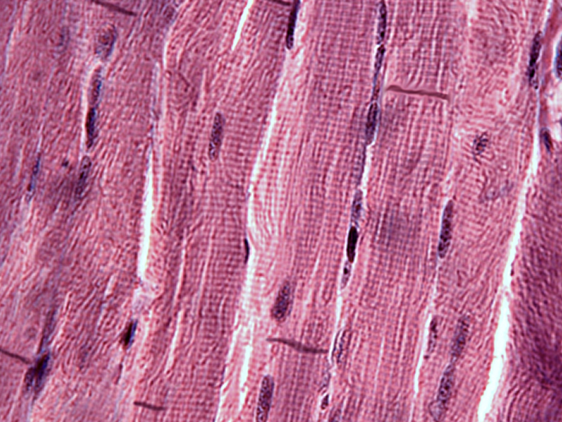 <p>more mitochondria than skeletal, intercalated discs</p>