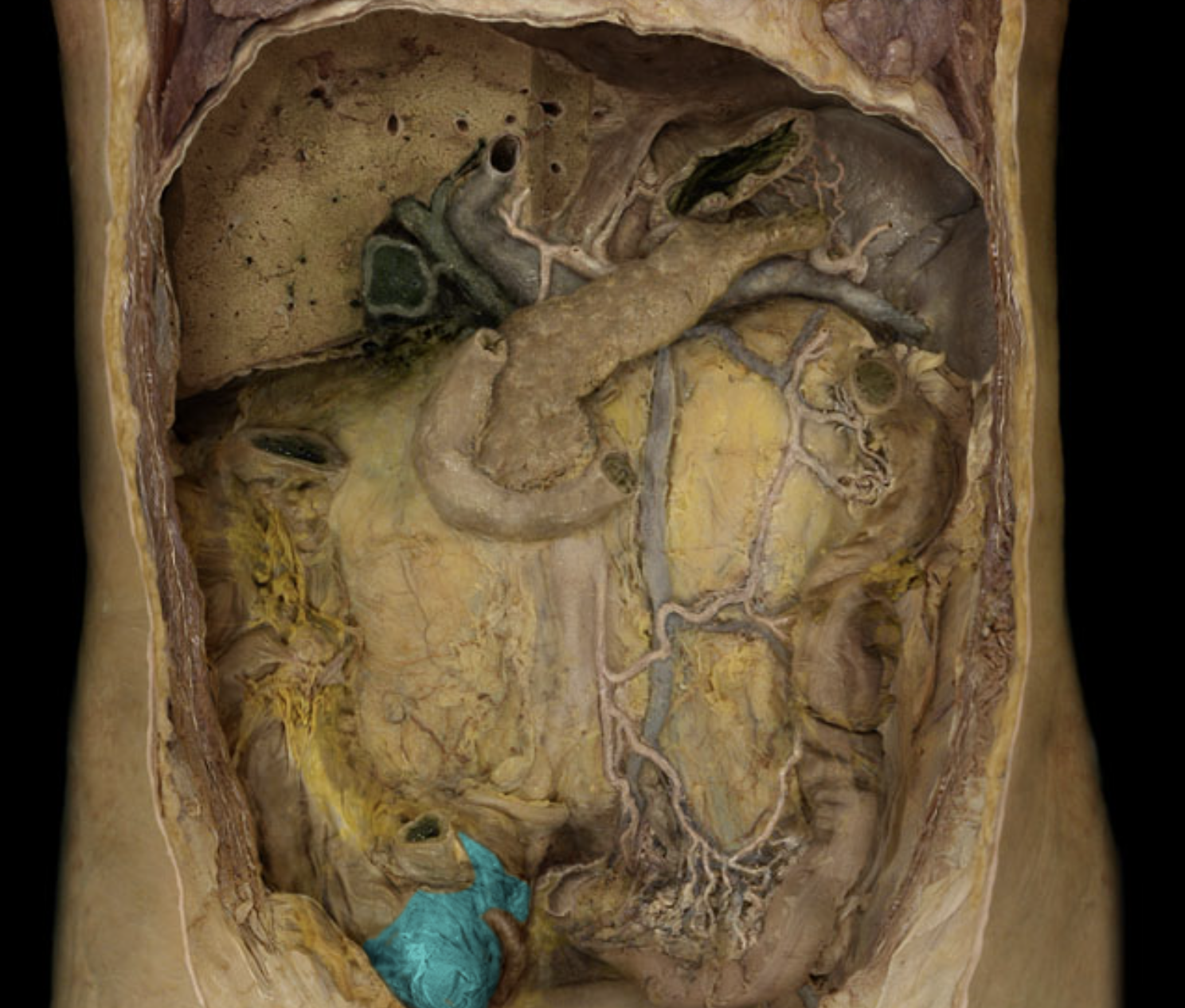 term image