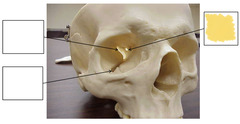 <p>Anterior View of Orbit</p>