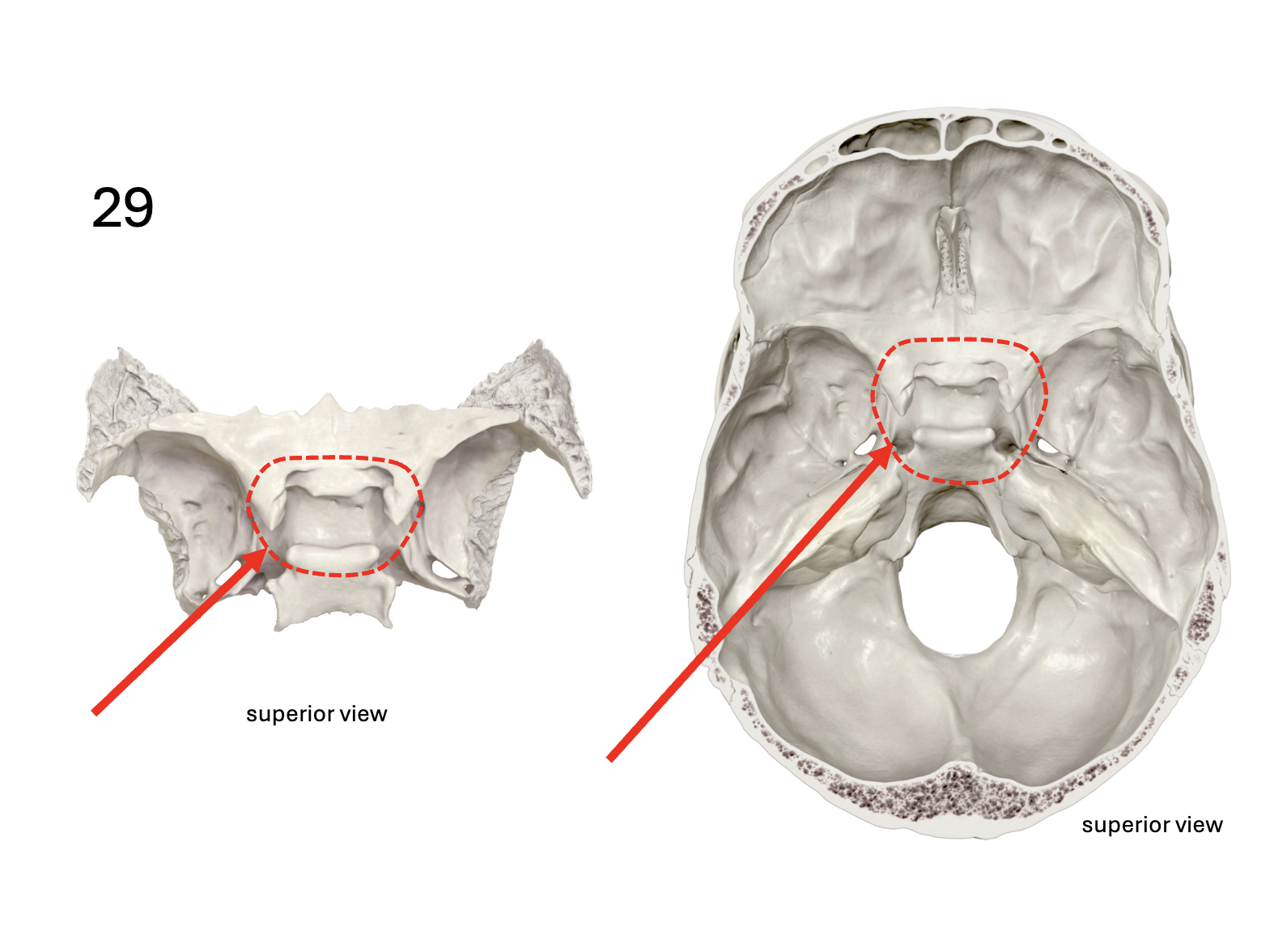 <p>Identify the <strong>bone and landmark</strong></p>