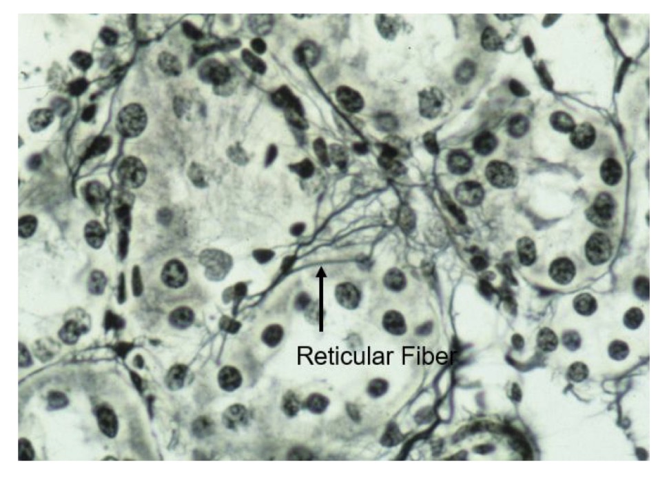 <p>reticular fibers (made of thin collagen)</p><p>requires PAS and silver stain</p><p>cells mostly fibroblasts</p><p>found in kidney and liver (organs that are squishable)</p>
