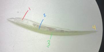 <p>Phylum</p><p>Subphylum</p>