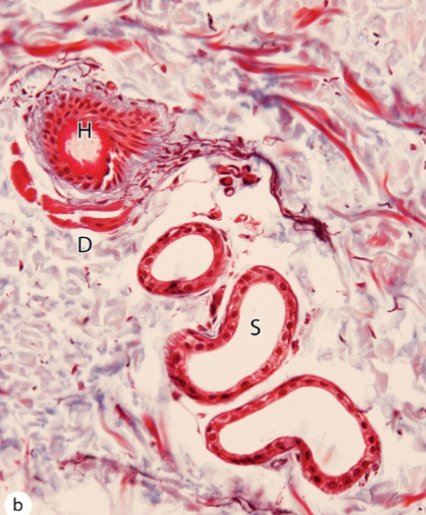 <p>What is this and what is the shape of the lumen </p>