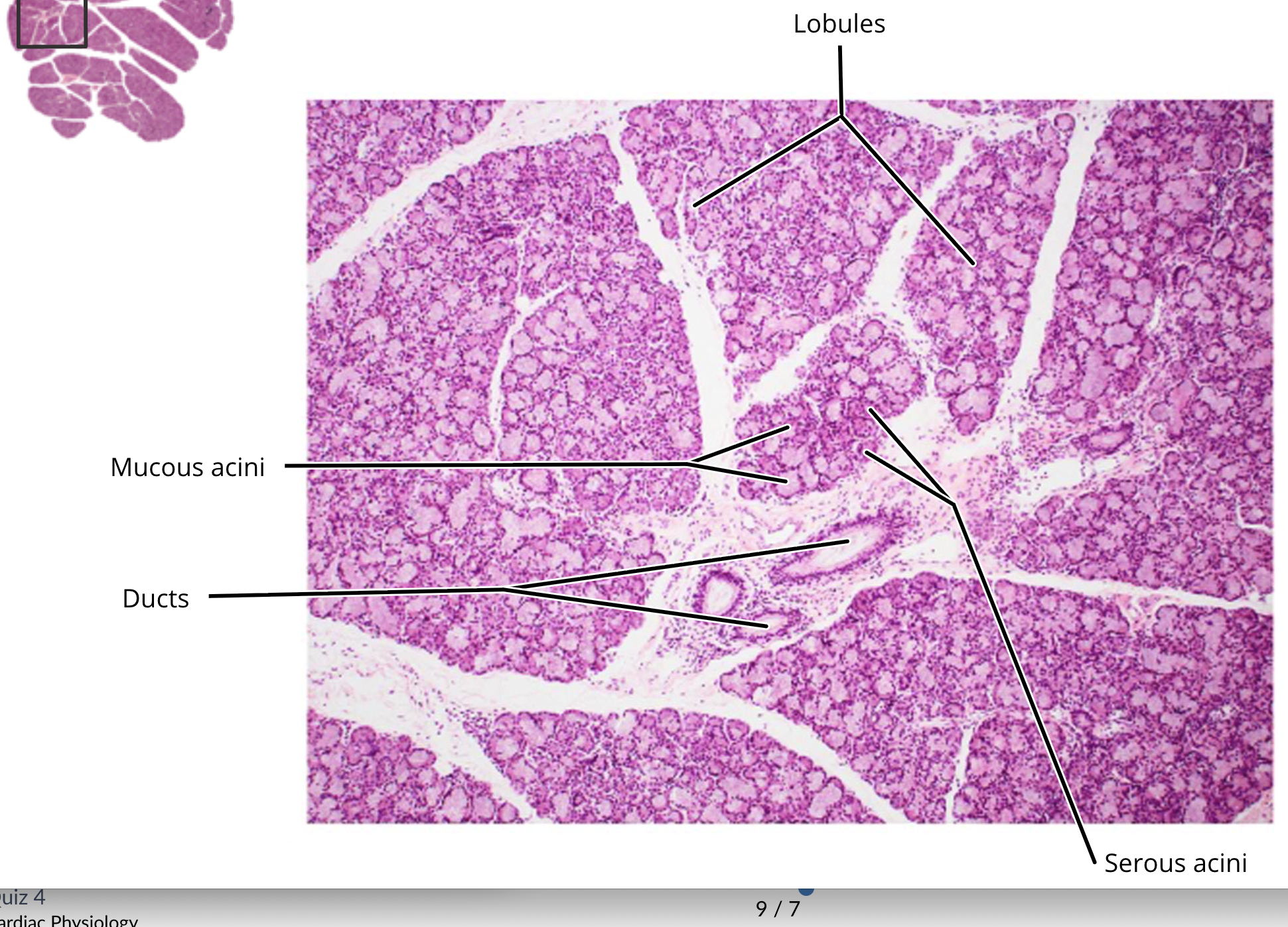 <p></p><ul><li><p><strong>mucous cells </strong></p></li><li><p><strong>ducts </strong></p></li><li><p><strong>serous acini cells </strong></p></li></ul><p></p>