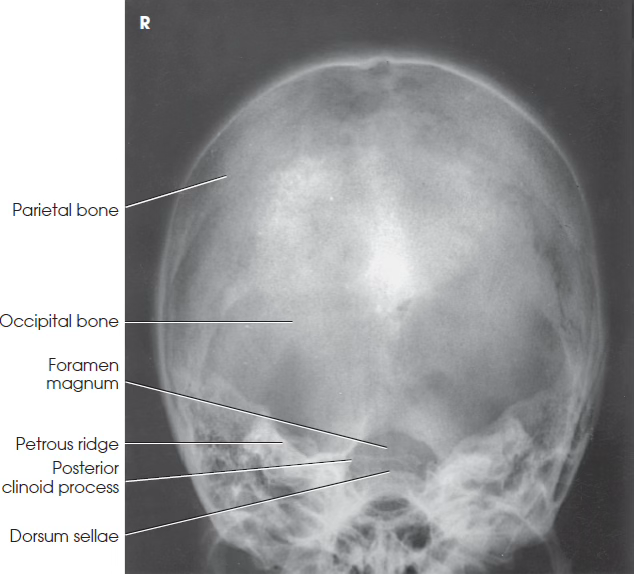<p>What view is this?</p>
