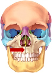 <p>the suture between the two maxillae of the upper jawbone</p>