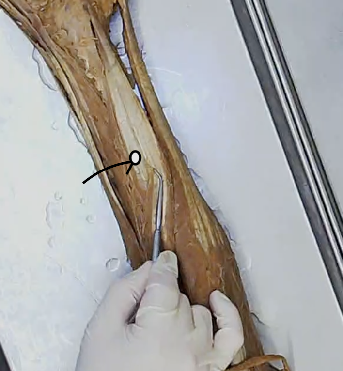 <p>Deep to fibularis longus</p>