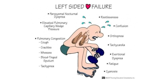 <p>cuased by MVS, MVR, AVS, AVR</p><p>expect : diuretics, ace, arb, blood thinner</p><p>goes back to lungs </p>