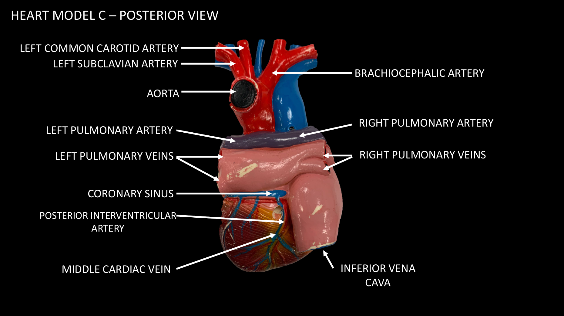 <p>LEFT PULMONARY VEINS</p>