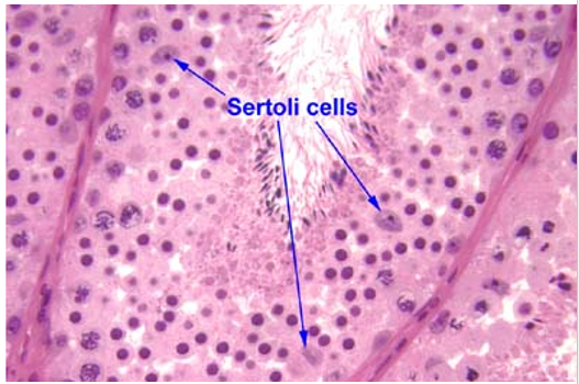 <p>Færre antal end spermatogene celler!</p><ul><li><p><strong>LM: </strong>Cylindriske og strækker sig fra basalmembranen helt til lumen«—» Mange laterale udløbere mellem de spermatogene celler«—»Cytoplasma grænse kan ikke skelnes«—» <strong><em>Store, lys, oval/kantet kerne</em></strong>«—» <strong><em>meget stor, tydelig nucleolus</em></strong></p></li><li><p><strong>EM:</strong> Zonulae occludentes til andre sertoliceller via udløberne, som danner <strong><em>blod-testis barriere«</em></strong>—» Gap junctions til andre sertoliceller«—» Lipiddråber«—»Veludviklet sER</p></li></ul><p></p>