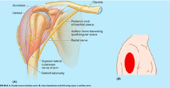 <p>The superior lateral brachial cutaneous nerve</p>