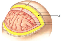 <p>thick, outermost layer of the meninges surrounding and protecting the brain and spinal cord, contains many sensory endings.</p>