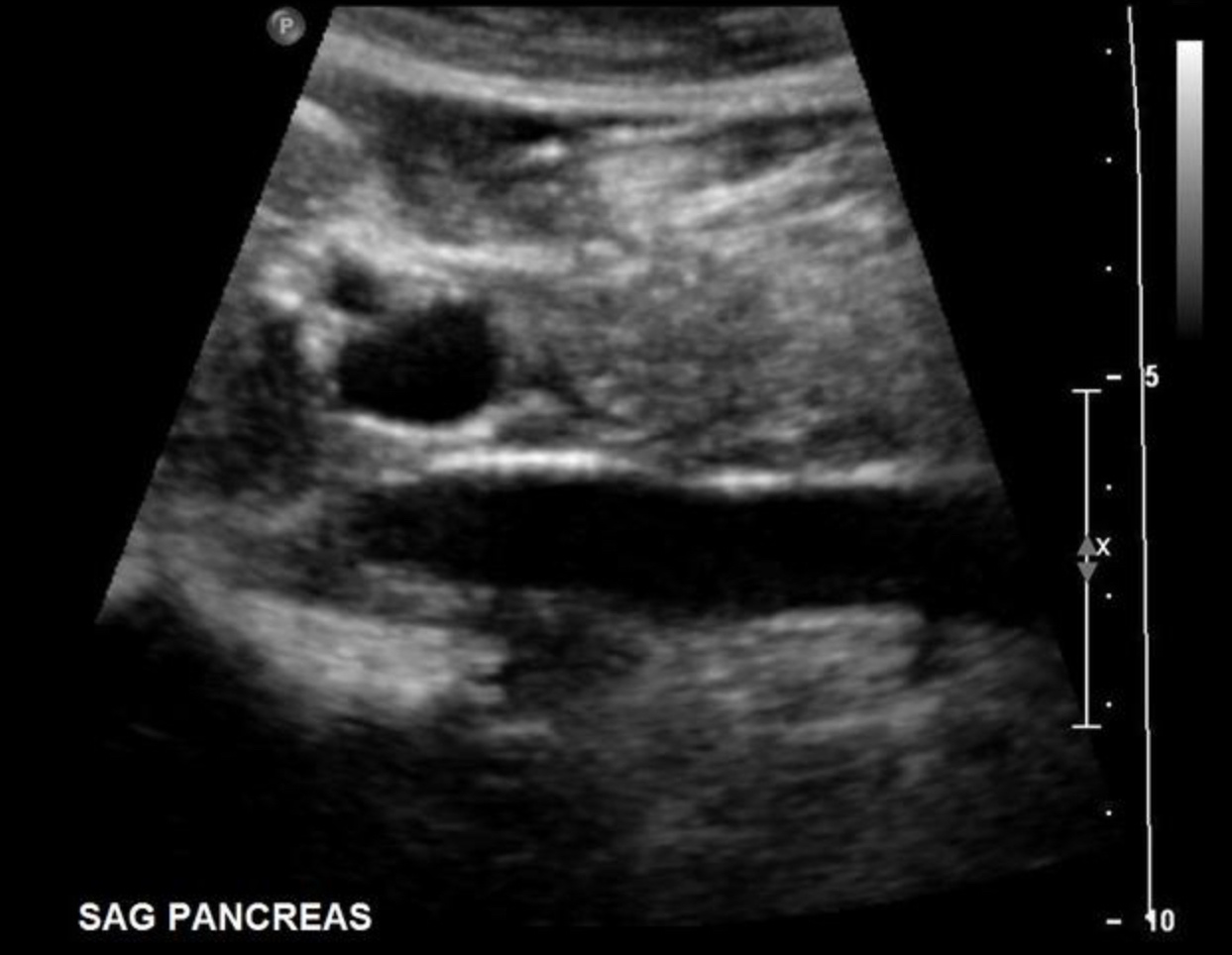 <p>Use your mouth to place your cursor over the hepatic artery and click to mark the vessel.</p>