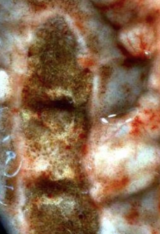 <p><u>Definition:</u> Acute, apparently contagious, foul-smelling enteritis occurring during colder months of the year</p><ul><li><p>High morbidity and low mortality</p></li></ul><p><u>Agent:</u> Likely coronavirus</p><p><u>Signalment:</u> Housed cattle</p><p><u>Treatment:</u> Supportive (fluids ONLY)</p><p><u>Prevention:</u> NONE</p>