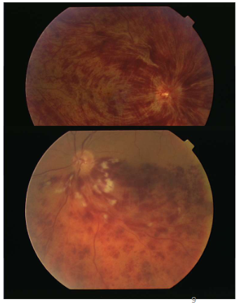 <p>Name the condition</p>