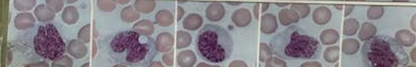 <p>What white blood cell is this</p>