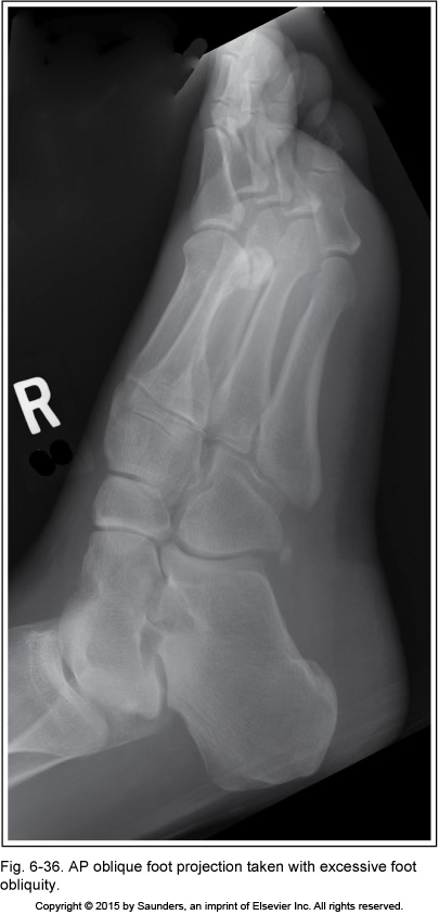 <p>AP oblique foot</p>