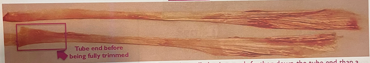 <p>-wide, flaring fan end that usually begins further down the tube compared to posterior tendon</p><p>-tube end can appear similar to second fan end before cleaning</p>