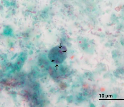 <p>Fractured karyosome? Binucleated (hint for the name of this amoeba)?</p>