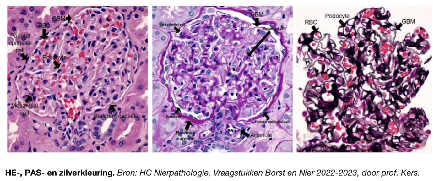 <ul><li><p>gebruikt voor nierbiopt</p></li><li><p>hematoxyline-eosine kleuring(HE-kleuring) = celkernen blauw en cytoplasma +collageen bindweefsel roze</p><ul><li><p>ernstige onsteking = veel blauw celkernen</p></li></ul></li><li><p>PAS-kleuring = lijkt op dat hierboven, hier is echter ook kapsel van Bowman goed zichtbaar</p></li><li><p>zilverkleuring = scherp zwart randje een cappilaire wand weergeven. rood = bloedcellen</p><ul><li><p>kan hiermee podocyten en masengium onderscheiden</p></li><li><p>kan zien of onsteking in of buiten capillair zit</p></li></ul></li></ul><p></p>