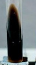 <p><strong><mark>growth</mark></strong><mark> and a </mark><strong><mark>dark brown or black discoloration</mark></strong><mark> of the medium</mark></p><p></p><p>Bacteria that can survive the 4% bile salts and hydrolyze esculin produce esculetin, which reacts with ferric ions in the medium to create a dark pigment. [1, 2, 3]</p><ul><li><p><span><strong>Positive Result:</strong></span></p><ul><li><p><span><strong>Appearance:</strong> Diffuse blackening of more than half of the agar slant, or dark halos around colonies on plates.</span></p></li><li><p><span><strong>Indications:</strong> Presumptive identification of <strong>Group D streptococci</strong> (e.g., <em>Streptococcus bovis</em>) and <strong>Enterococcus</strong> species (e.g., <em>Enterococcus faecalis</em>).</span> [1]</p></li></ul></li></ul><p></p>