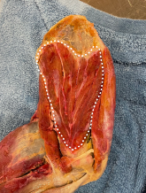 <p>Identify the muscle</p>