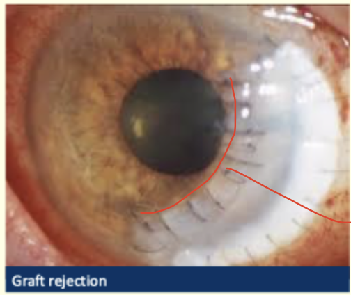 <p>Describe and diagnosis</p>