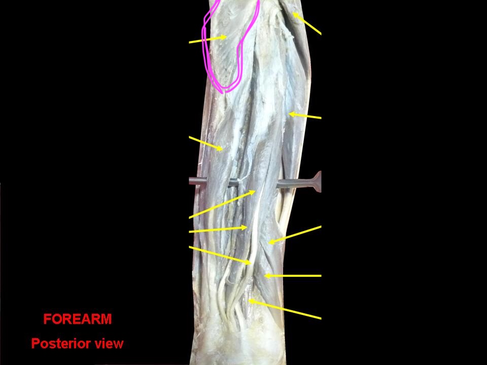 <p>What is the innervation of this muscle?</p>