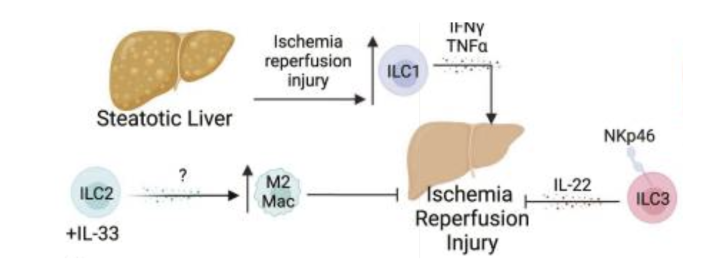 <ul><li><p><span style="background-color: transparent; font-family: "Open Sans", sans-serif;"><strong>ILC1s</strong></span></p><ul><li><p><span style="background-color: transparent; font-family: "Open Sans", sans-serif;">Worsen ischemia-reperfusion injury (IRI)</span></p></li></ul></li><li><p><span style="background-color: transparent; font-family: "Open Sans", sans-serif;"><strong>ILC2s</strong></span></p><ul><li><p><span style="background-color: transparent; font-family: "Open Sans", sans-serif;">Induce type 2 (wound healing) macrophage activity</span></p></li><li><p><span style="background-color: transparent; font-family: "Open Sans", sans-serif;">May contribute to chronic fibrosis - can lead to chornic graft rejection</span></p></li></ul></li><li><p><span style="background-color: transparent; font-family: "Open Sans", sans-serif;"><strong>ILC3s</strong></span></p><ul><li><p><span style="background-color: transparent; font-family: "Open Sans", sans-serif;">Protective against ischemia-reperfusion injury</span></p></li><li><p><span style="background-color: transparent; font-family: "Open Sans", sans-serif;">May promote regeneration</span></p></li></ul></li><li><p><span style="background-color: transparent; font-family: "Open Sans", sans-serif;"><em>Most data comes IRI model of steatotic liver, limited allogeneic data</em></span></p></li></ul><p></p>