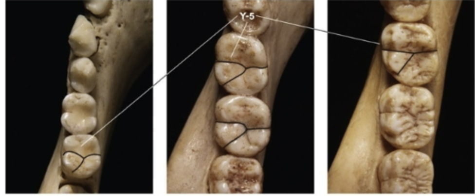 <p>Y-5 lower molars</p>