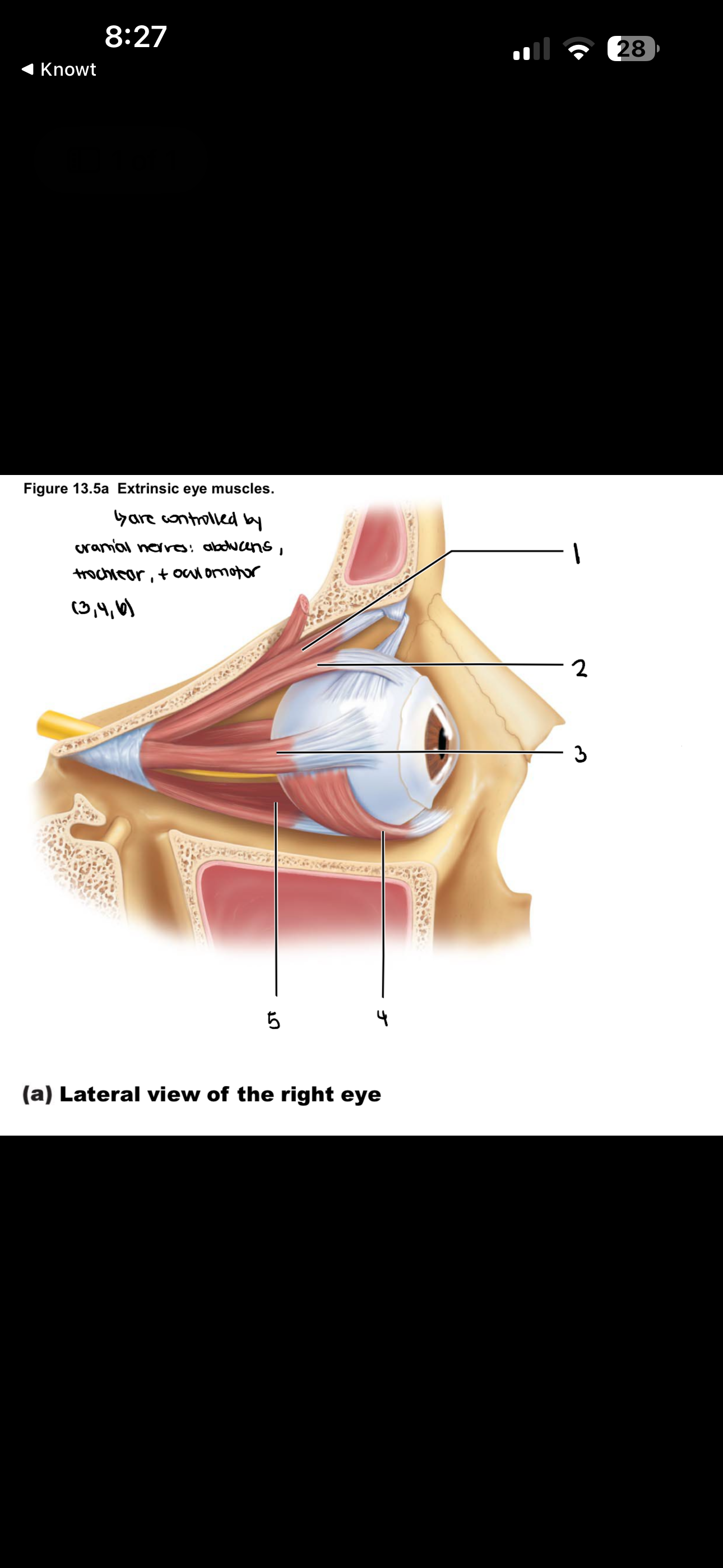 <p>this makes up the extrinsic eye muslces</p>