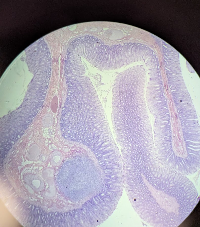 <p>Where in the body is this</p>